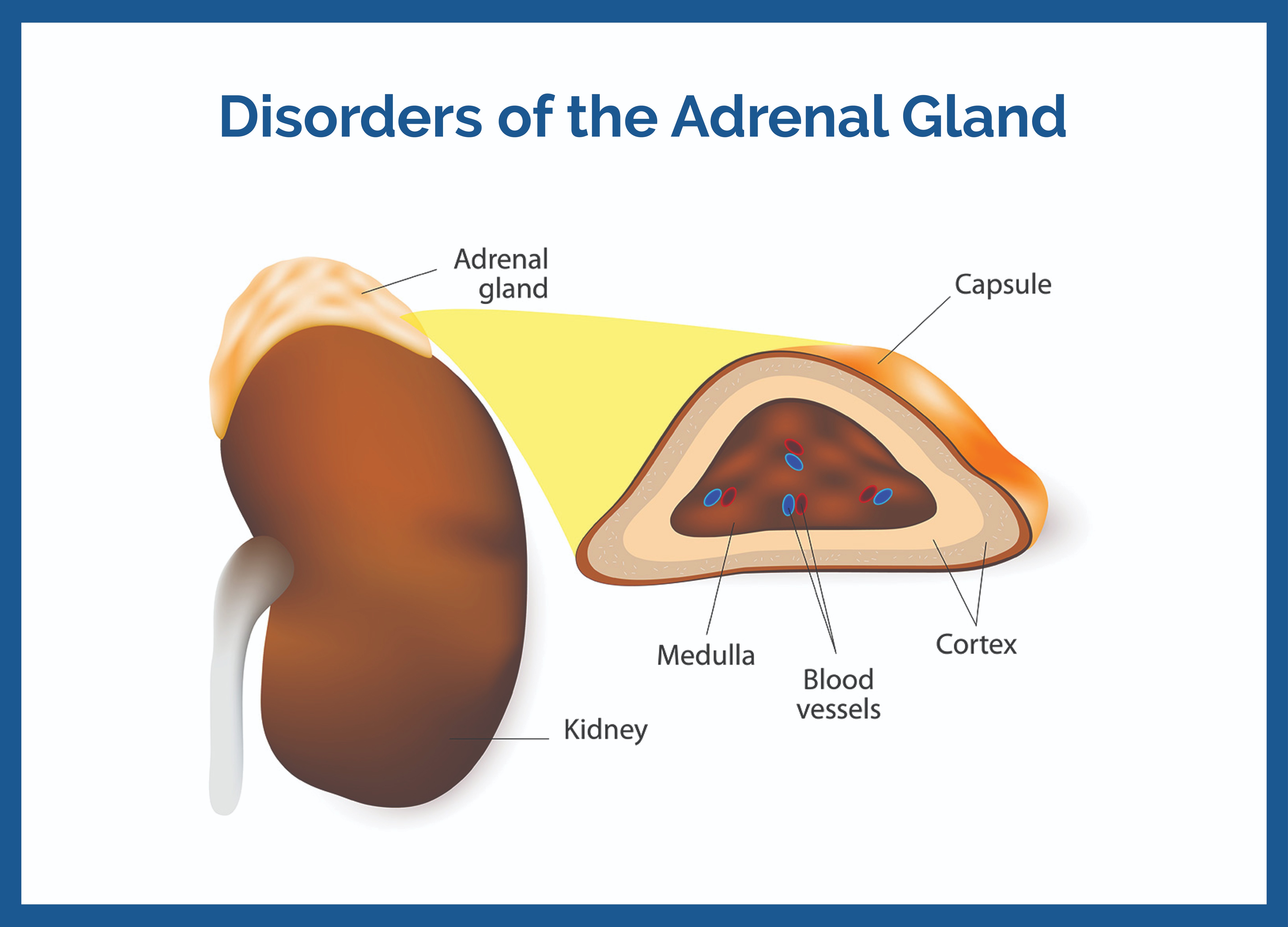 Adrenal Gland Disorders Causes Symptoms Treatments Adrenal Gland Disorders Causes Symptoms Treatments